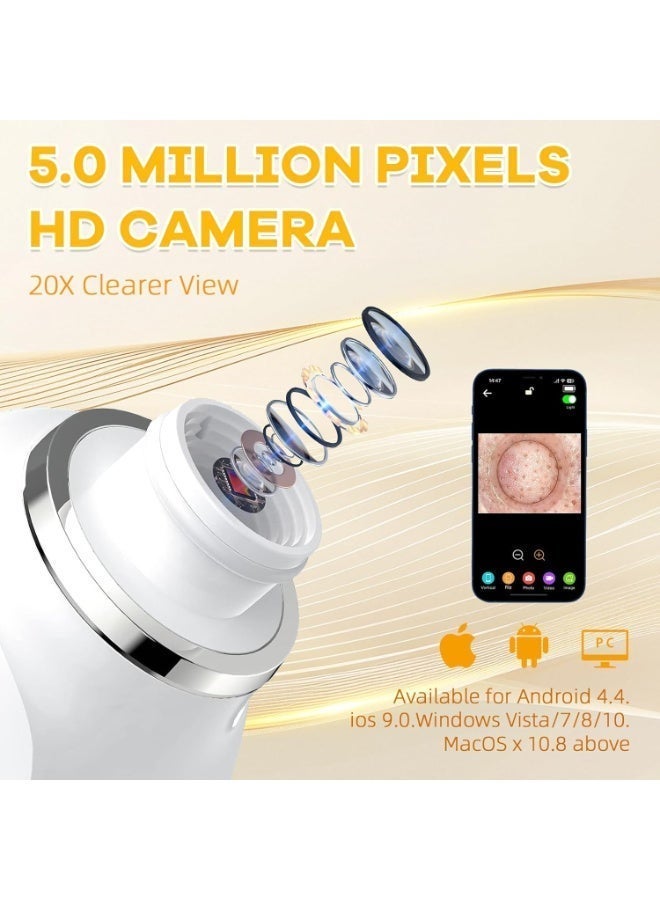 general 2025 Pore Vacuum with Camerafor, USB Rechargeable Blackhead Remover Vacuum,3 Levels Adjustable Pore Vacuum Blackhead Remover, 6 Suction Heads,Face Vacuum Pore Cleanser for Women & Men-Light Purple - Image 2